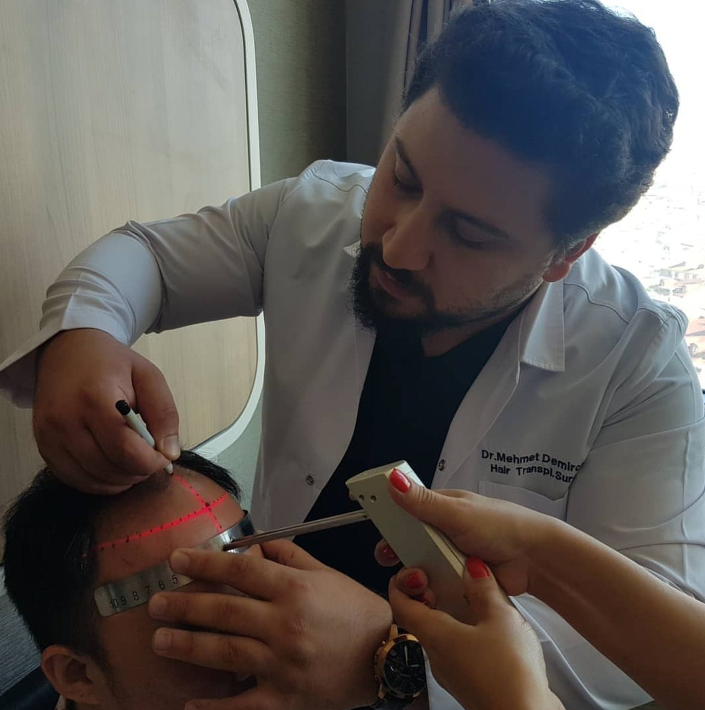 10 Best Hair Transplant Clinics In Turkey Topteny Magazine