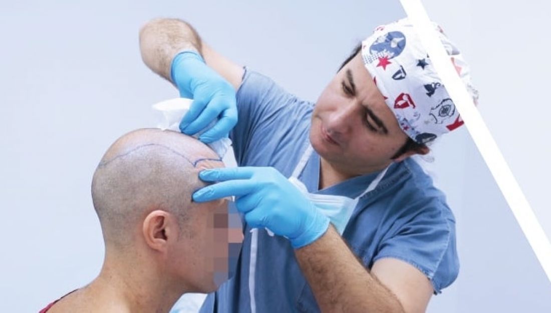 10 Best Hair Transplant Clinics in Turkey in 2021 | TopTeny.com